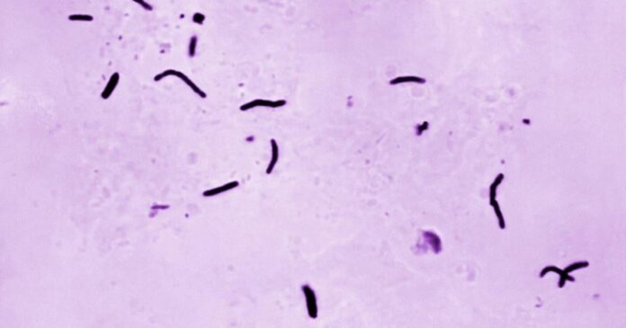 Global tuberculosis diagnoses rise to a record, but deaths fall, WHO reports