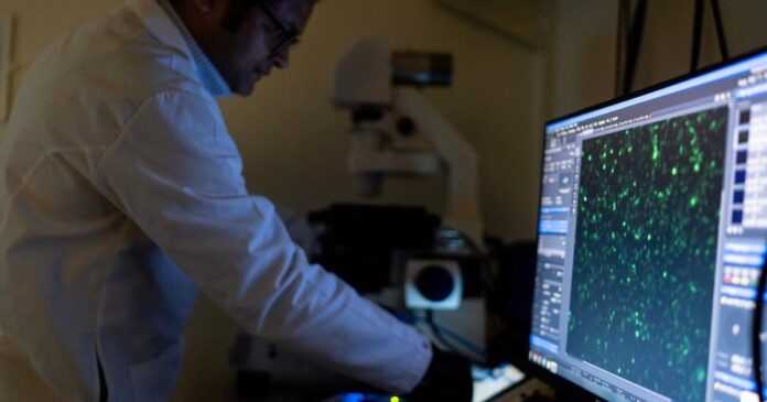 Autoimmune diseases can strike any part of the body, and mostly affect women. Here’s what to know